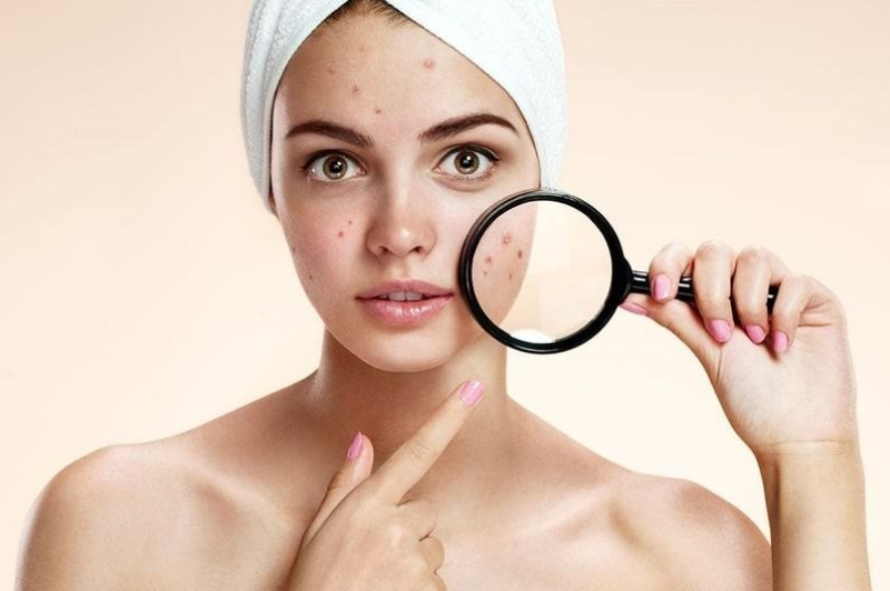 Ung thư da là gì?