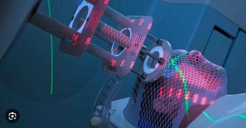 Phương pháp điều trị ung thư vòm họng