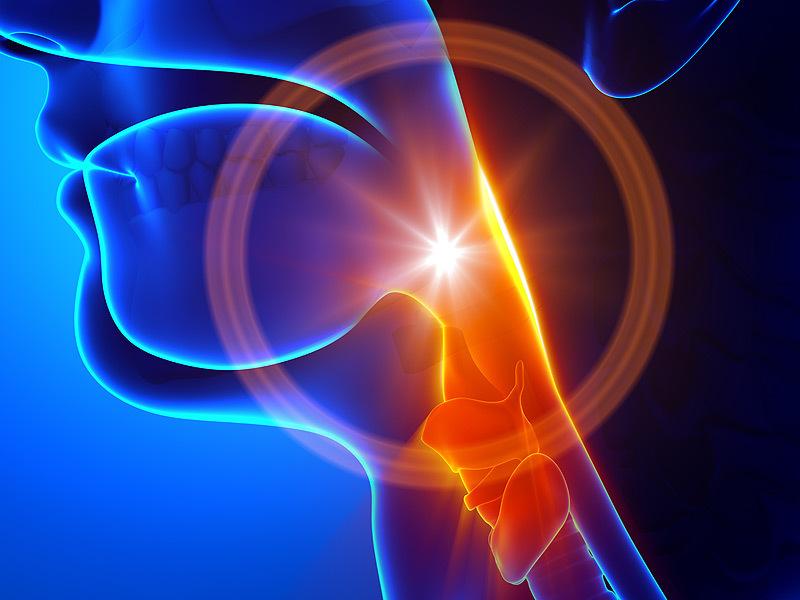 Có 2 giai đoạn của bệnh ung thư vòm họng ở giai đoạn cuối