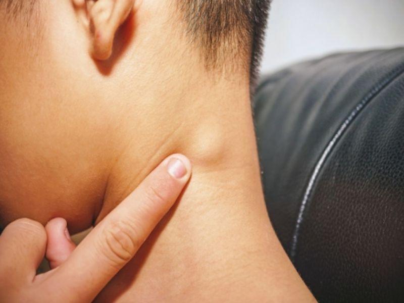 Dấu hiệu ung thư tuyến giáp ở trẻ