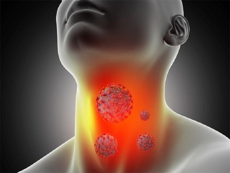 Thời gian ủ bệnh ung thư vòm họng