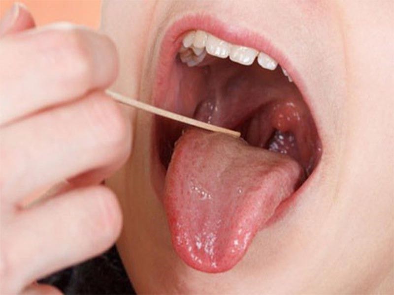 Ung thư vòm họng xuất hiện ở độ tuổi nào?