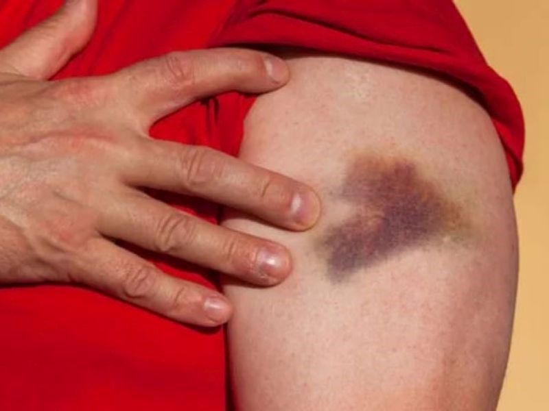 Các phương pháp điều trị ung thư máu