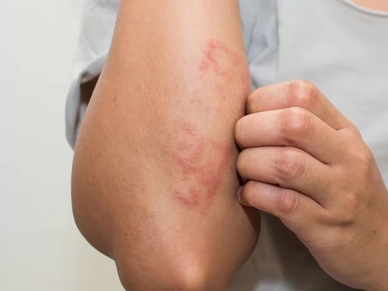 Các phương pháp điều trị ung thư máu