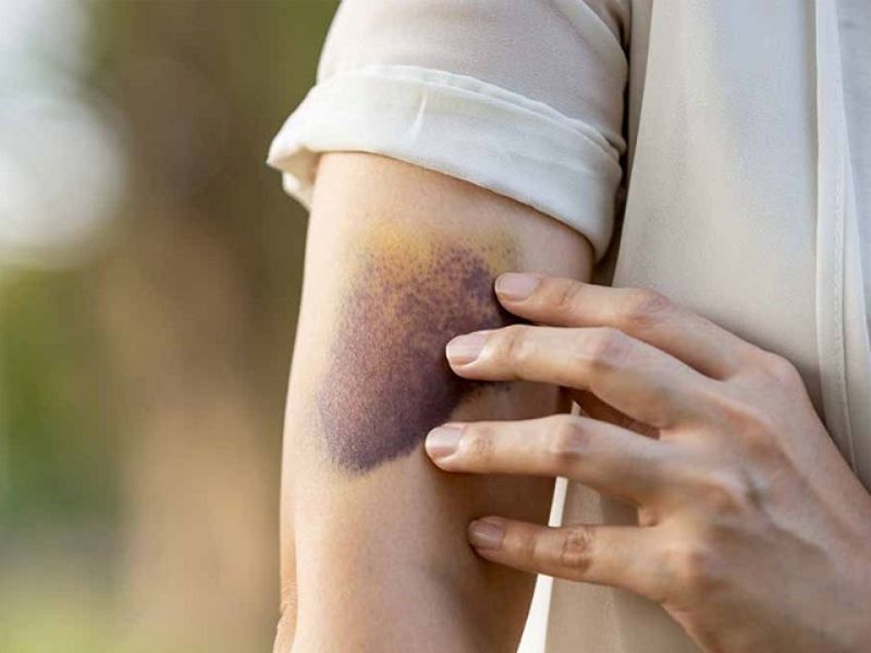 Căn bệnh ung thư máu