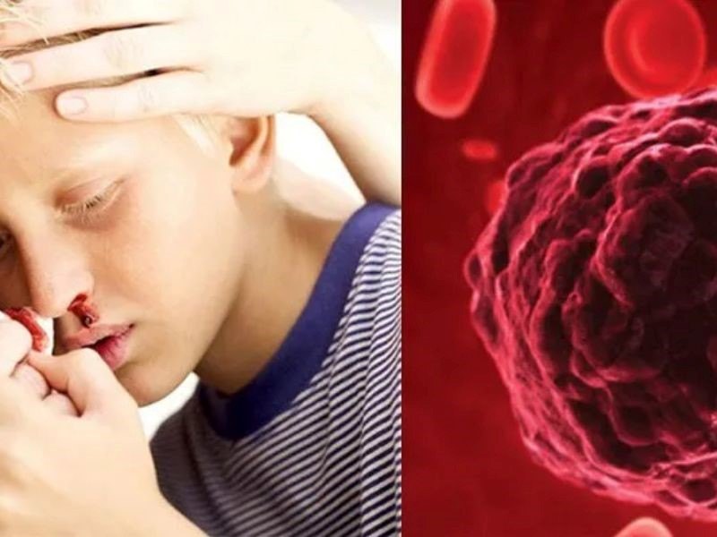 Căn bệnh ung thư máu
