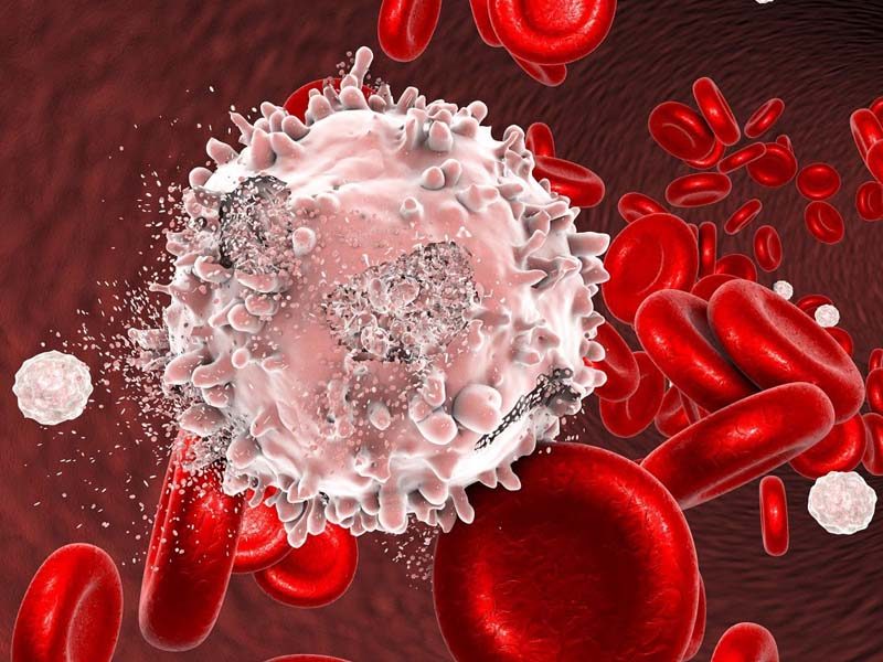 Căn bệnh ung thư máu rất nguy hiểm