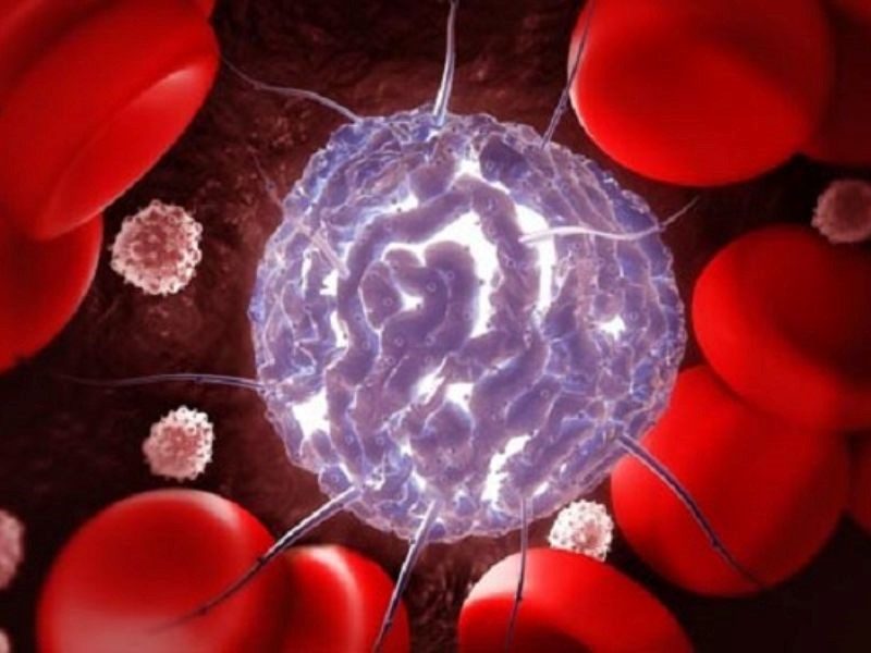 Cơ chế của căn bệnh máu trắng