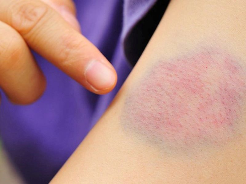 Ung thư máu có chữa được không?