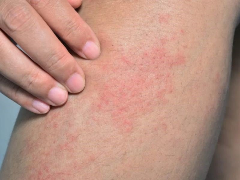 Ung thư máu sống được bao lâu?