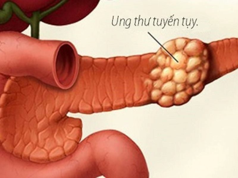Các phương pháp điều trị