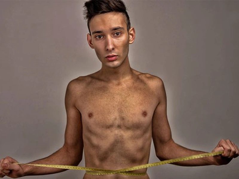 Dấu hiệu bệnh suy dinh dưỡng