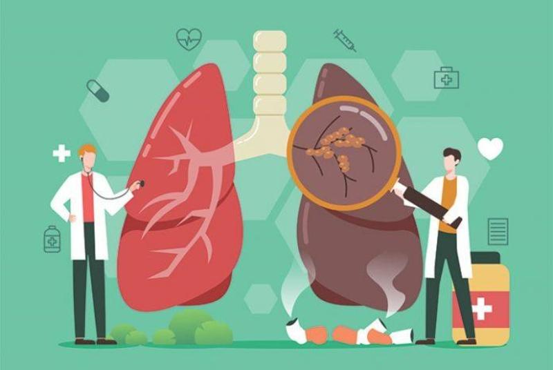 Ung thư phổi là gì