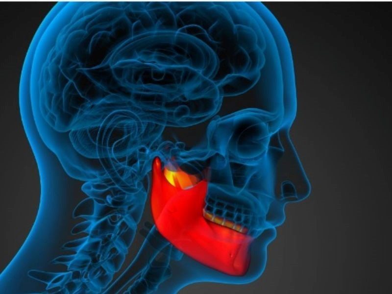 Chẩn đoán ung thư xương hàm