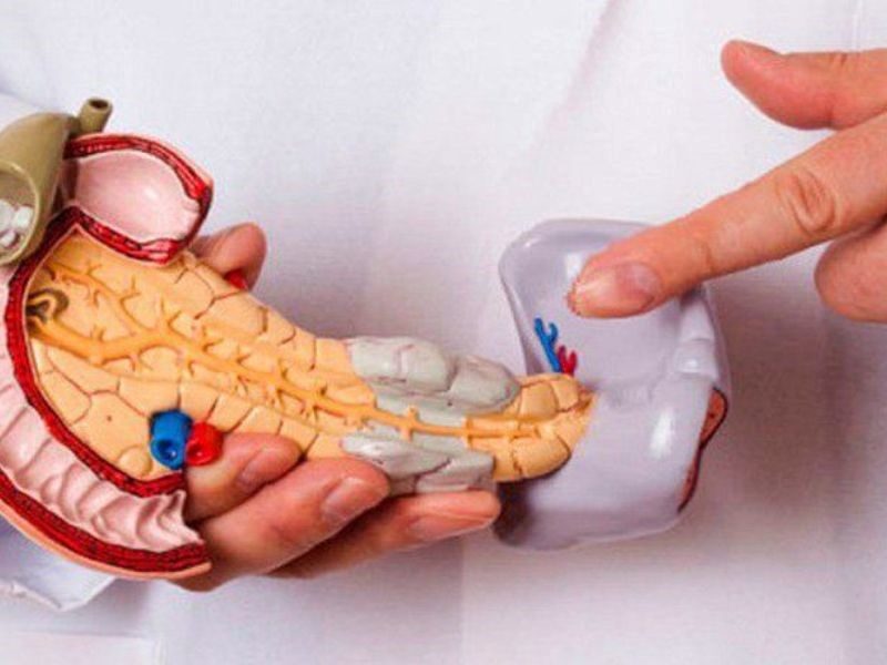 Thời gian sống của bệnh nhân ung thư tuyến tụy phụ thuộc vào nhiều yếu tố