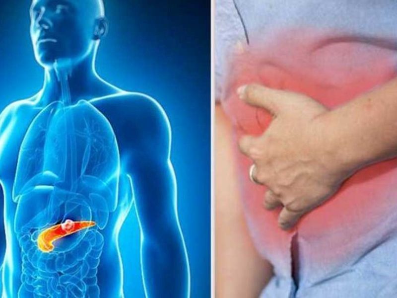 Tiên lượng sống của bệnh nhân ung thư tuyến tụy