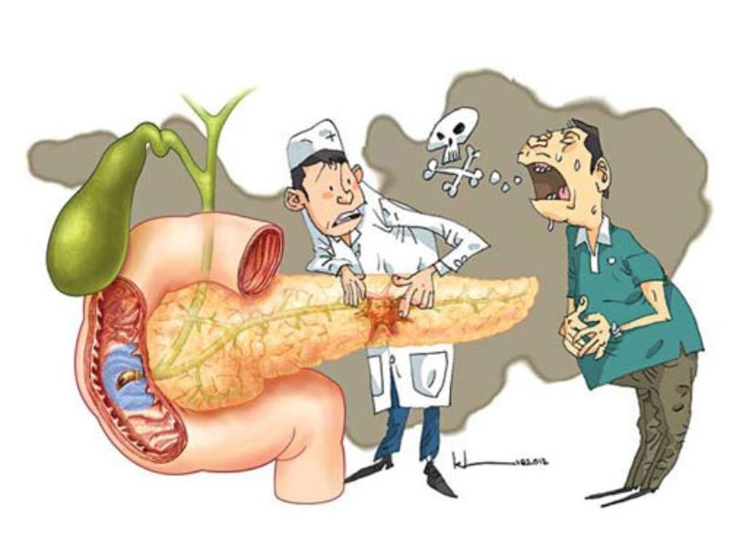 Ung thư tuyến tụy có chữa được không?