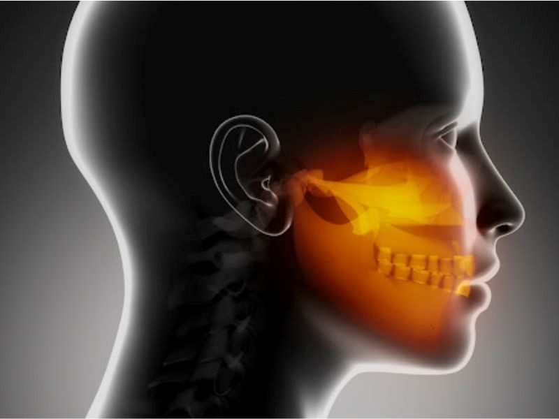 Ung thư xương hàm có chữa được không?