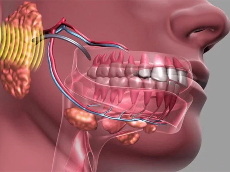 Ung thư xương hàm là căn bệnh hiếm gặp