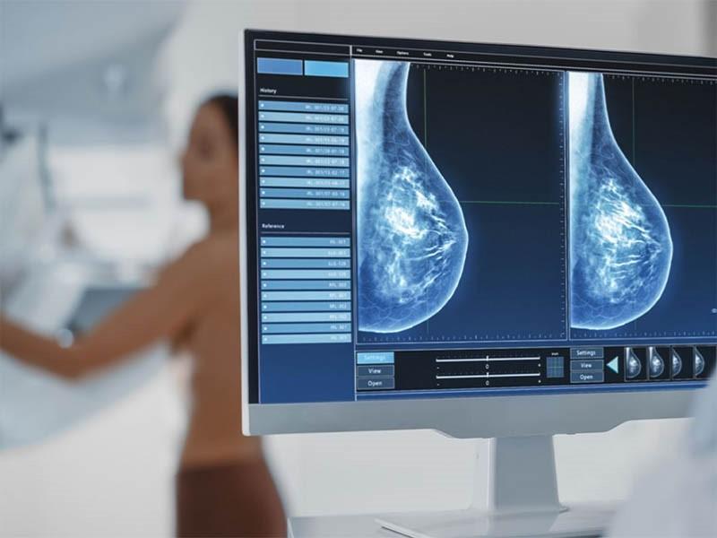 Cách chẩn đoán ung thư vú dạng viêm