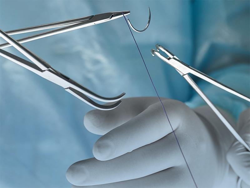 Phẫu thuật ung thư tuyến tiền liệt