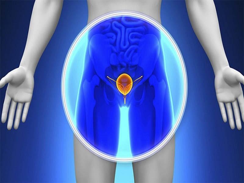 Ung thư tuyến tiền liệt giai đoạn 4