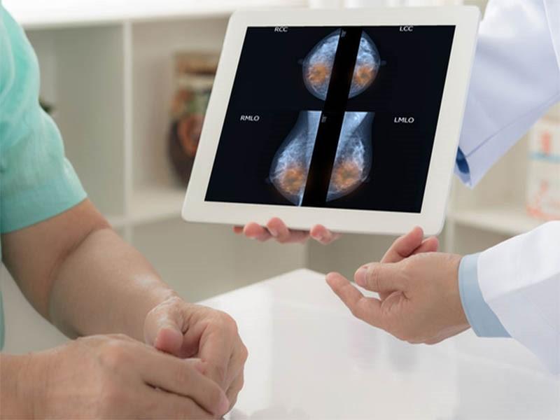 Yếu tố làm tăng nguy cơ mắc ung thư vú giai đoạn 4