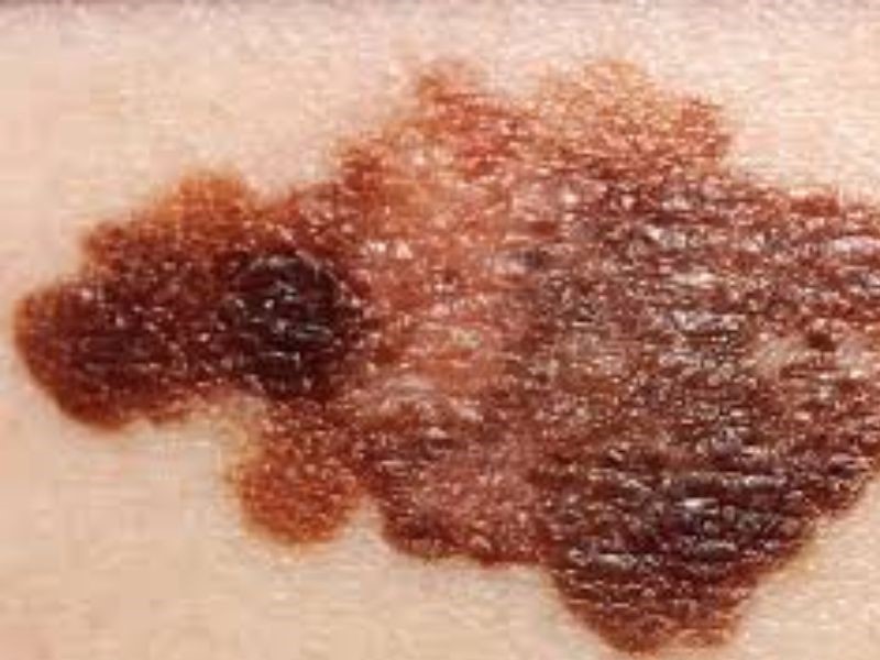 Các dấu hiệu nghiêm trọng