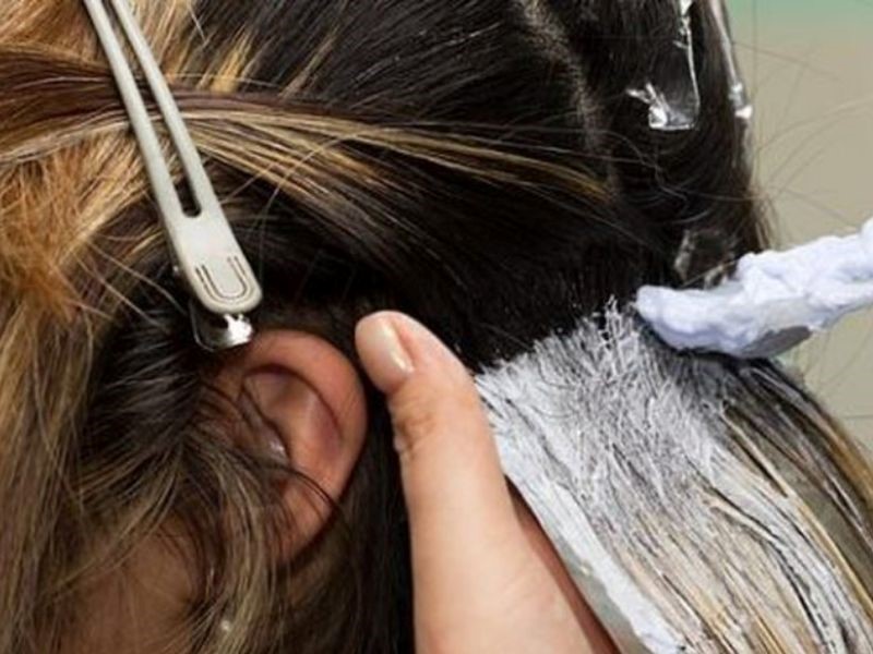 Nguyên nhân gây ung thư da đầu