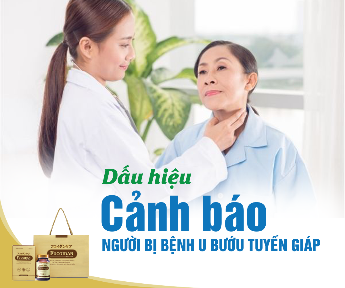 Dấu hiệu cảnh báo bạn bị bệnh u tuyến giáp