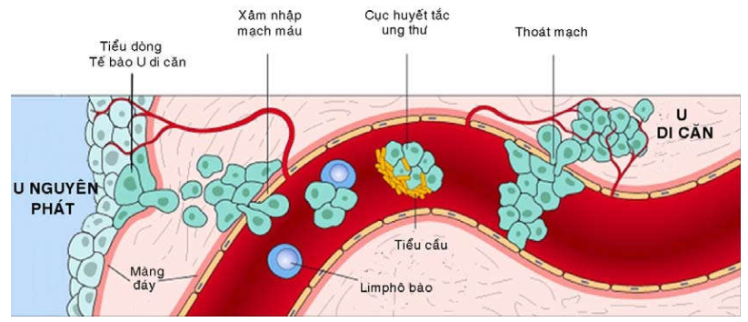 Phương Pháp Điều Trị Hiện Đại