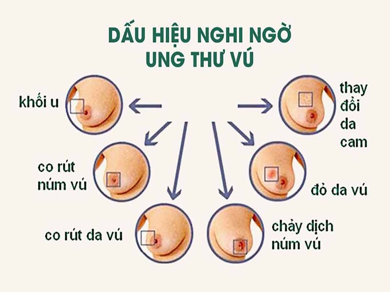 Dấu hiệu của căn bệnh