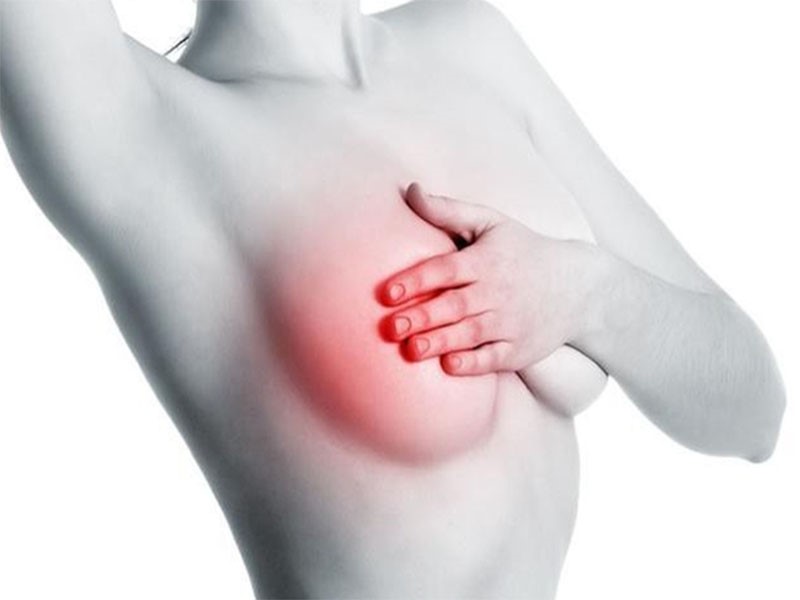 Dấu hiệu ung thư vú giai đoạn đầu