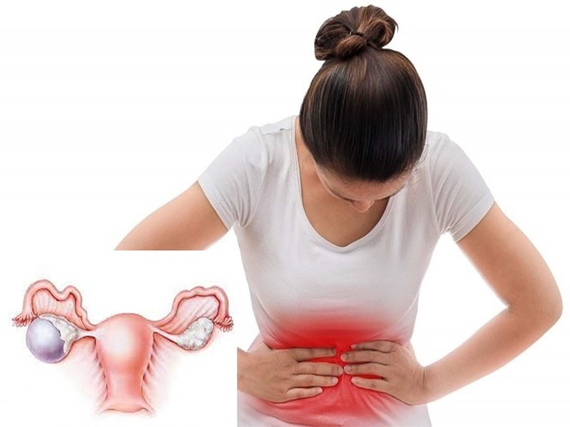 Phương pháp điều trị u nang buồng trứng