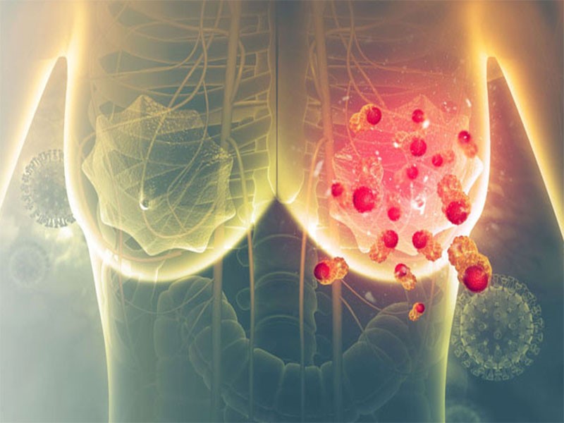 Xuất hiện các vết lõm ở ngực