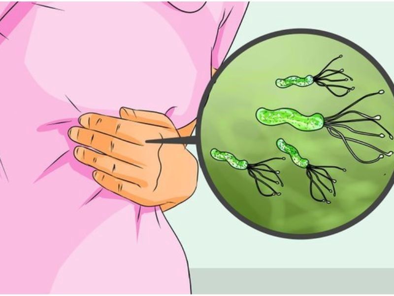 Khi nào cần điều trị HP?