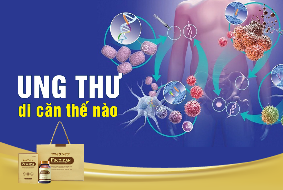 Ung thư di căn là gì, ung thư di căn có chữa được không?