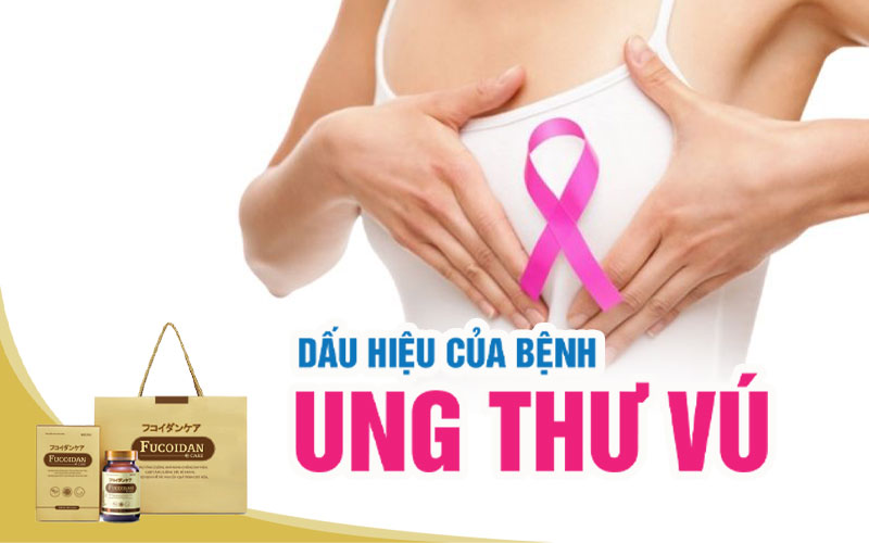 Ung thư vú là gì  và dấu hiệu ung thư vú như thế nào?